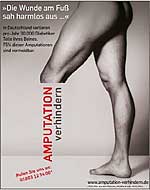 Amputation verhindern