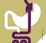 Prinzip der Magenbypass-Operation Prinzip der Magenbypass-Operation