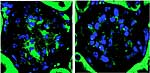 Nierenkörperchen diabetischer Mäuse