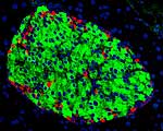 Fluoreszenzmikroskopische Aufnahme einer Langerhans-Insel der
Bauchspeicheldrüse