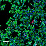 In Kultur gehaltene Inselzellen der Maus In Kultur gehaltene Inselzellen der Maus