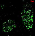 Nierenkörperchen (in grün) im Mikroskop Nierenkörperchen (in grün) im Mikroskop