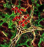 Betazellen der Bauchspeicheldrüse Betazellen der Bauchspeicheldrüse