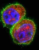 T-Zellen nach Stimulation in Gegenwart von miRNA181a T-Zellen nach Stimulation in Gegenwart von miRNA181a