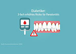 Diabetes: 3-fach erhöhtes Risiko für Parodontitis. Diabetes: 3-fach erhöhtes Risiko für Parodontitis.